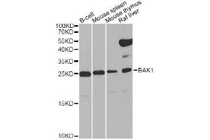 Western blot analysis of extracts of various cell lines, using BAK1 Antibody (ABIN5970038) at 1/1000 dilution. (BAK1 anticorps  (N-Term))