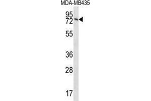 UNC84B Antibody (Center) western blot analysis in MDA-MB435 cell line lysates (35 µg/lane). (SUN2 anticorps  (Middle Region))