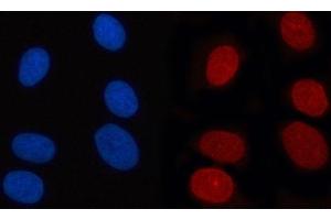 IF analysis of RANBP2 using anti-RANBP2 antibody (ABIN7602650). (RANBP2 anticorps  (AA 906-2744))