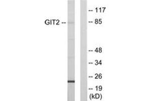 Western blot analysis of extracts from HepG2 cells, using GIT2 Antibody.
