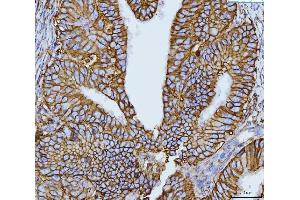 IHC analysis of CD147/Emmprin using anti-CD147/Emmprin antibody (ABIN7599999). (CD147 anticorps  (AA 138-323))