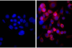 Human pancreatic carcinoma cell line MIA PaCa-2 was stained with Mouse Anti-Cytokeratin 18-UNLB and DAPI. (Chèvre anti-Souris IgG (Heavy & Light Chain) Anticorps (HRP) - Preadsorbed)