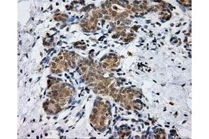 Immunohistochemical staining of paraffin-embedded breast tissue using anti-PTPRE mouse monoclonal antibody. (PTPRE anticorps)