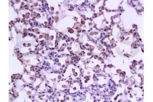 Formalin-fixed and paraffin embedded rat lung tissue labeled with Anti-STAT3 Polyclonal Antibody, Unconjugated at 1:200 followed by conjugation to the secondary antibody, (SP-0023), and DAB staining(ABIN738261) Formalin-fixed and paraffin embedded rat lung tissue labeled with Anti-STAT3 Polyclonal Antibody, Unconjugated at 1:200 followed by conjugation to the secondary antibody, (SP-0023), and DAB staining