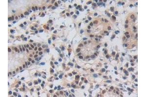 Detection of NUP50 in Human Stomach Tissue using Polyclonal Antibody to Nucleoporin 50 kDa (NUP50)