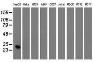 Image no. 2 for anti-OTU Domain, Ubiquitin Aldehyde Binding 2 (OTUB2) antibody (ABIN1499937) (OTUB2 anticorps)