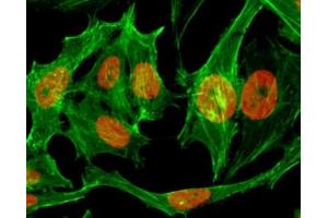 ICC/IF testing of human HeLa cells treated with sodium butyrate using recombinant H3K9me1 antibody (red).