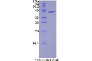SDS-PAGE analysis of Mouse WFDC5 Protein.