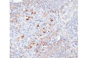 Immunohistochemistry of paraffin-embedded Rat ovary using SMPD1 / ASM Polyclonal Antibody at dilution of 1:100 (40x lens). (SMPD1 anticorps)