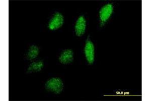 Immunofluorescence of purified MaxPab antibody to IPPK on HeLa cell. (IPPK anticorps  (AA 1-491))