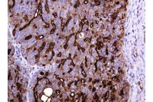 Image no. 9 for anti-Mucin 1 (MUC1) antibody (ABIN1499598)