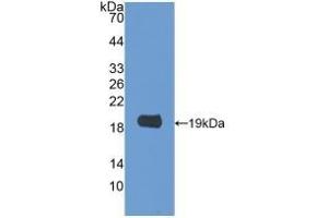 Detection of Recombinant GAL2, Rat using Polyclonal Antibody to Galectin 2 (GAL2) (Gallinacin-2 (GAL2) (AA 1-130) anticorps)