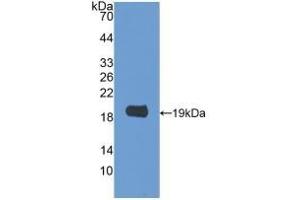 Detection of Recombinant GAL2, Rat using Polyclonal Antibody to Galectin 2 (GAL2) (Galectin 2 anticorps  (AA 1-130))