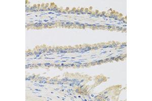 Immunohistochemistry of paraffin-embedded human prostate using INSL3 antibody at dilution of 1:100 (40x lens). (INSL3 anticorps)