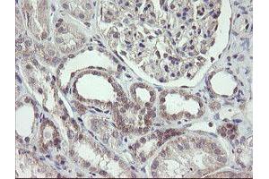 Image no. 5 for anti-F-Box Protein 42 (FBXO42) (AA 356-717) antibody (ABIN1491449) (FBXO42 anticorps  (AA 356-717))