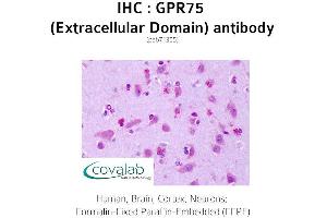Image no. 1 for anti-G Protein-Coupled Receptor 75 (GPR75) (2nd Extracellular Domain) antibody (ABIN1735159)