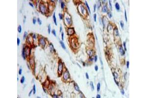 Used in DAB staining on fromalin fixed paraffin-embedded Stomach tissue (VAPA anticorps  (AA 1-249))