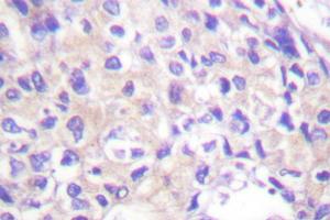 Image no. 1 for anti-Ribosomal Protein S6 Kinase, 90kDa, Polypeptide 1 (RPS6KA1) antibody (ABIN271935) (RPS6KA1 anticorps)
