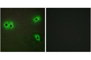 Immunofluorescence analysis of A549 cells, using Collagen XIII alpha1 Antibody. (COL13A1 anticorps  (AA 641-690))