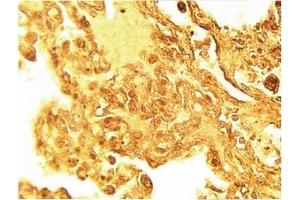 Image no. 1 for anti-serine Palmitoyltransferase, Long Chain Base Subunit 1 (SPTLC1) antibody (ABIN4620353) (SPTLC1 anticorps)