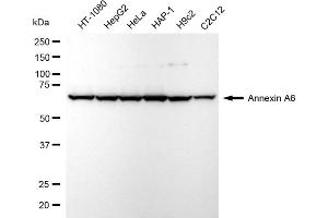 anti-Annexin A6 (ANXA6) antibody