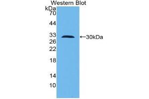 Western blot analysis of the recombinant protein. (TLR10 anticorps  (AA 20-250))