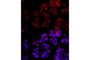 Immunofluorescence analysis of HepG2 cells using NUDT5 Rabbit mAb (ABIN7269071) at dilution of 1:100 (40x lens). (NUDT5 anticorps)