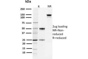 SDS-PAGE Analysis Purified PD-L1 Mouse Monoclonal Antibody (PDL1/2744). (PD-L1 anticorps  (AA 39-191))