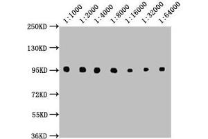 Western Blot Positive WB detected in: Raji whole cell lysate All lanes: CD19 antibody at 1:1000, 1:2000, 1:4000, 1:8000, 1:16000, 1:32000, 1:64000 Secondary Goat polyclonal to Mouse IgG at 1/10000 dilution Predicted band size: 61 kDa Observed band size: 95 kDa