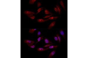 Confocal immunofluorescence analysis of U-2OS cells using EIF6 antibody (ABIN3022602, ABIN3022603, ABIN3022604 and ABIN6218936) at dilution of 1:50. (EIF6 anticorps  (AA 1-245))