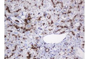 Image no. 9 for anti-Galactosidase, beta 1 (GLB1) antibody (ABIN1498467)