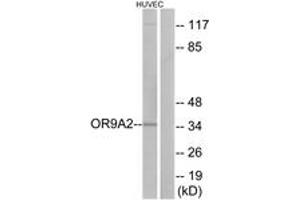 Western blot analysis of extracts from HuvEc cells, using OR9A2 Antibody. (OR9A2 anticorps  (AA 260-309))
