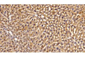 Detection of a1AT in Mouse Liver Tissue using Polyclonal Antibody to Alpha-1-Antitrypsin (a1AT)