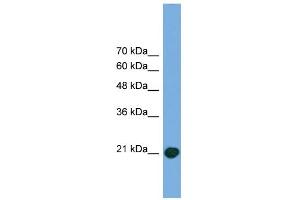 WB Suggested Anti-COMMD8 Antibody Titration: 0. (COMMD8 anticorps  (Middle Region))