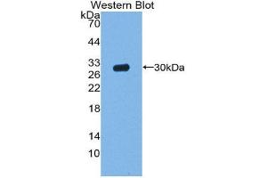 Western Blotting (WB) image for anti-Acid Phosphatase 5, Tartrate Resistant (ACP5) (AA 28-286) antibody (ABIN1857872) (ACP5 anticorps  (AA 28-286))