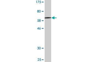 Western Blot detection against Immunogen (60.