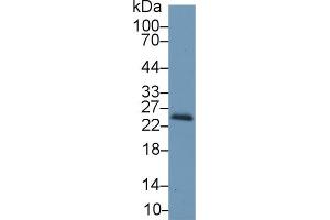 Western blot analysis of Mouse Kidney lysate, using Mouse RBP4 Antibody (1 µg/ml) and HRP-conjugated Goat Anti-Rabbit antibody ( (RBP4 anticorps  (AA 63-245))