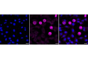 Immunocytochemical staining of C2C12 cells with Fibroblast growth factor 21 antibody (ABIN7798606), 1:1,000).