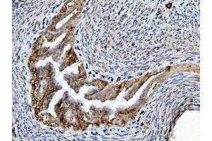 IHC analysis of PDIA6 using anti-PDIA6 antibody (ABIN7600553). (PDIA6 anticorps  (AA 20-440))