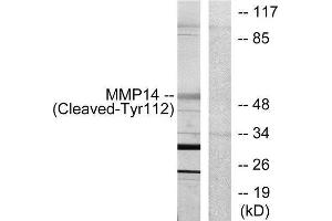 Western Blotting (WB) image for anti-Matrix Metallopeptidase 14 (Membrane-inserted) (MMP14) (Cleaved-Tyr112) antibody (ABIN1853592) (MMP14 anticorps  (Cleaved-Tyr112))