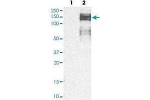 Western blot analysis of Lane 1: Human cell line RT-4; Lane 2: Human cell line U-251MG sp with ZEB1 polyclonal antibody  at 1:250-1:500 dilution. (ZEB1 anticorps)