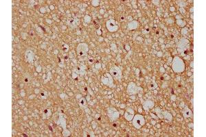 IHC image of ABIN7175445 diluted at 1:200 and staining in paraffin-embedded human brain tissue performed on a Leica BondTM system. (PTPLAD1 anticorps  (AA 1-145))