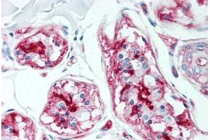 Human Skin, Sweat Glands (formalin-fixed, paraffin-embedded) stained with CD59 antibody ABIN298471 at 5 ug/ml followed by biotinylated anti-mouse IgG secondary antibody ABIN481714, alkaline phosphatase-streptavidin and chromogen. (CD59 anticorps)
