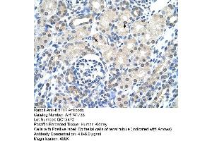 Rabbit Anti-KRT17 Antibody  Paraffin Embedded Tissue: Human Kidney Cellular Data: Epithelial cells of renal tubule Antibody Concentration: 4. (KRT17 anticorps  (C-Term))