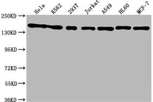 Western Blot Positive WB detected in: Hela whole cell lysate, K562 whole cell lysate, 293T whole cell lysate, Jurkat whole cell lysate, A549 whole cell lysate, HL60 whole cell lysate, MCF-7 whole cell lysate All lanes: SMC1A antibody at 1:1500 Secondary Goat polyclonal to rabbit IgG at 1/50000 dilution Predicted band size: 144 kDa Observed band size: 144 kDa (Recombinant SMC1A anticorps)