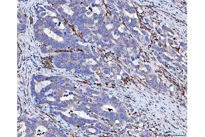 IHC analysis of Vimentin using anti-Vimentin antibody (ABIN3042344).