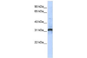 Western Blotting (WB) image for anti-Zinc Finger Protein 705D (ZNF705D) antibody (ABIN2459412) (ZNF705D anticorps)