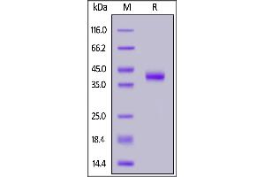 Human Mucin-1 (116-173), Fc Tag on  under reducing (R) condition.