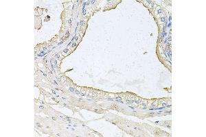 Immunohistochemistry of paraffin-embedded human prostate using HPR antibody (ABIN6003630) at dilution of 1/100 (40x lens). (HPR anticorps)