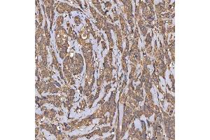 IHC analysis of HSD11B2 using anti-HSD11B2 antibody (ABIN7602698).